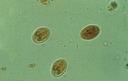 https://www.google.fr/search?sourceid=navclient&ie=UTF-8&oq=&hl=fr&rlz=1T4GGHP_frDZ652DZ652&q=Giardia(Intestinalis)+Lamblia&tbm=isch&gws_rd=ssl